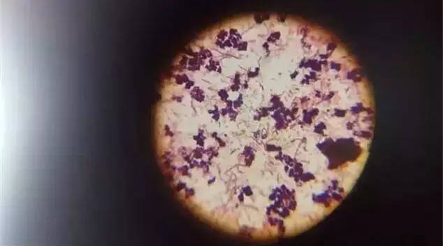 传疯了！只因家人一个习惯性的动作，1岁宝宝从头到脚染满病毒！