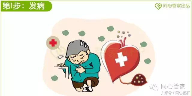 急性心梗心脏骤停如何抢救,急性心梗抢救过来后遗症会怎样