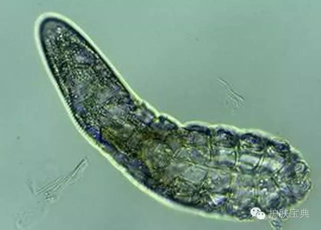有螨虫的皮肤该怎么处理,螨虫真的和皮肤没有关系吗