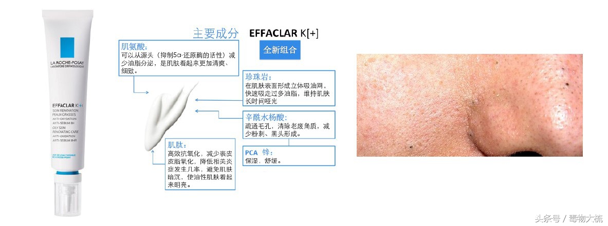 祛痘打假测评,祛痘产品良心测评打假
