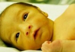 成人先天性非溶血性黄疸怎样鉴别,病理性黄疸会引起脑瘫吗