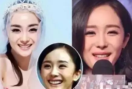 爱笑的女孩法令纹都很深,爱笑的女孩法令纹都不会太差