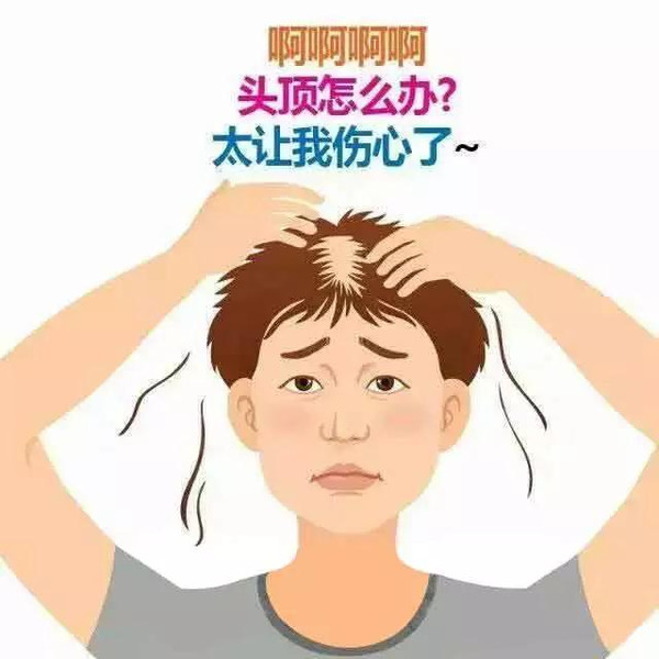 头顶脱发四指深算几级脱发,额头不脱发但头顶上脱发怎么回事