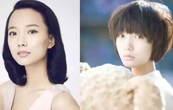 拯救发际线扁塌头发,拯救发际线告别大额头