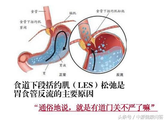 咳嗽20多天吃了药老不好,老年人咳嗽吃药就好不吃就不好