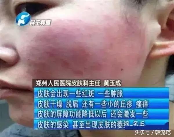 敷完美白面膜却感觉脸黑了怎么办,海藻面膜为什么敷完之后会变白