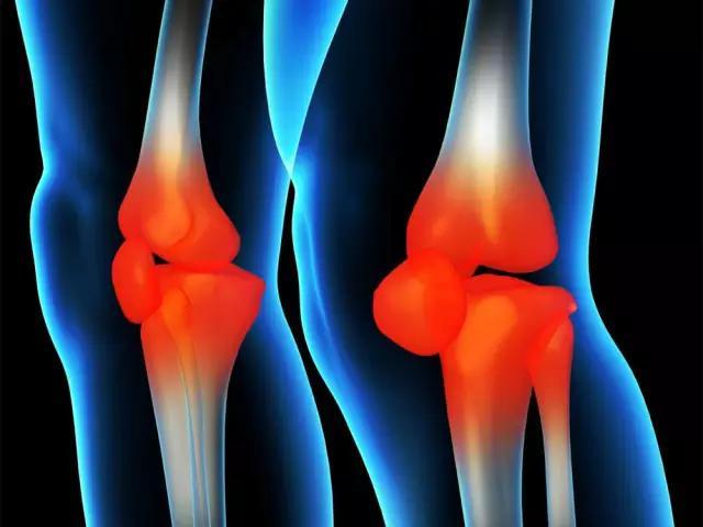 关节炎平时应该注意哪些,关节炎好诊断吗