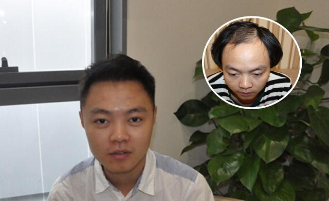 这道便宜菜补钙有奇效,治疗脱发的菜