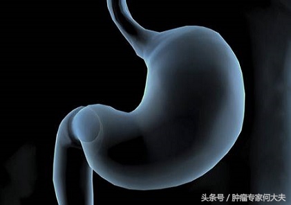 恶心呕吐没当回事，半年后被诊断为胃癌晚期