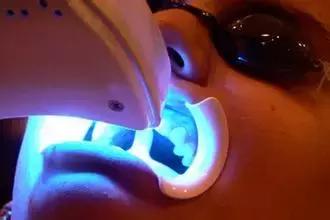 怎么做牙不会疼,牙不好看怎么微笑自然又好看