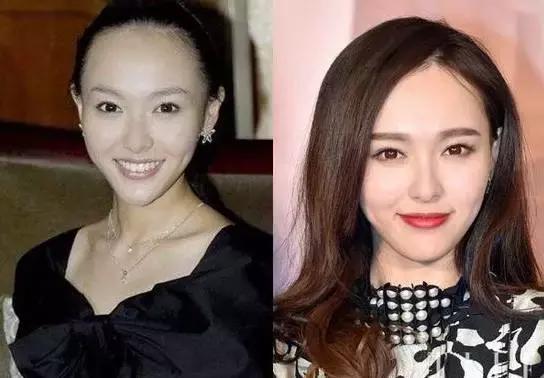 拯救发际线扁塌头发,拯救发际线告别大额头