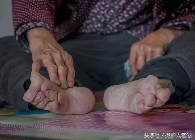100岁的缠足老人,九十五岁奶奶讲述缠足痛苦
