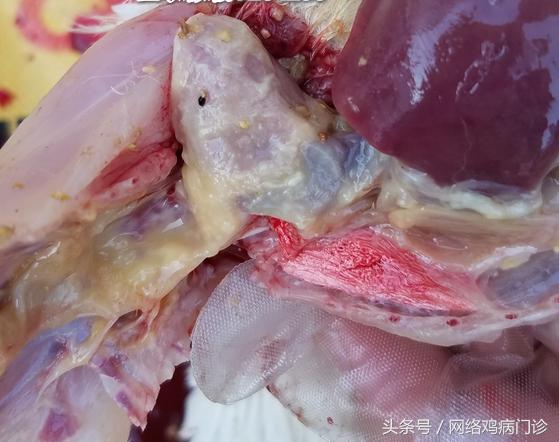 腺肌症治愈的病例分享,鸡腺肌胃炎的治疗成功案例