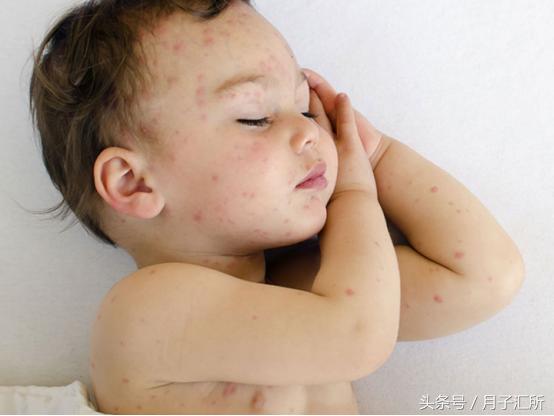 婴儿不睡觉都长黑眼圈了,睡眠时间很长但是有黑眼圈