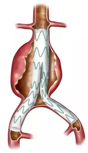 有一种病英文名,有一种病