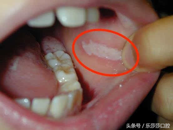 为什么吃饭会咬到舌头和腮帮,吃饭经常咬到腮或者舌头