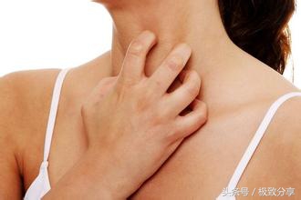 夏季皮肤瘙痒有绝招,皮肤燥热发痒有什么药方治