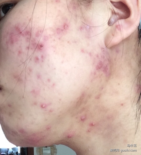 精准护肤问答,护肤问答每天解决一个小问题