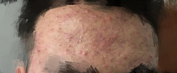 精准护肤问答,护肤问答每天解决一个小问题