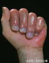 浙一的全科医学科,浙一运动医学科