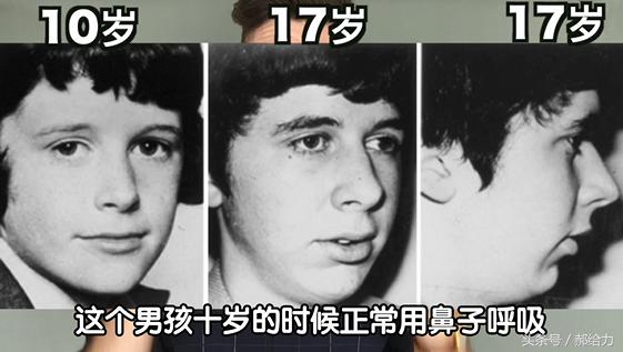 怎样把下巴变长下颚线更明显,什么运动可以让下颚线变明显