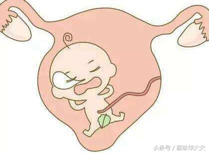 孕13周胎盘下缘覆盖宫颈口要紧吗,孕13周胎盘覆盖宫口