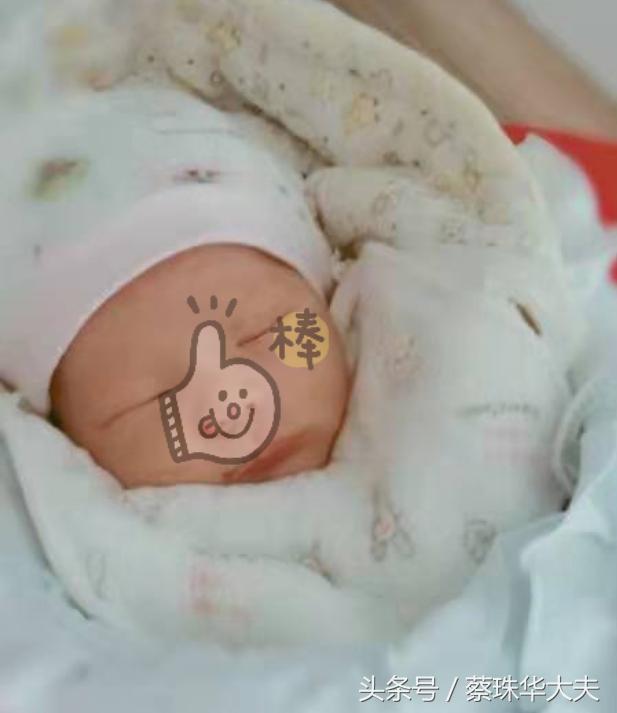 磷脂抗体指标高,磷脂抗体iga