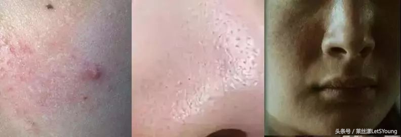 1盒10片蜗牛原液面膜,1盒10片补水面膜