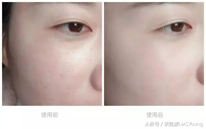 1盒10片蜗牛原液面膜,1盒10片补水面膜