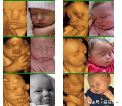 怀孕日记のD136-D150变化