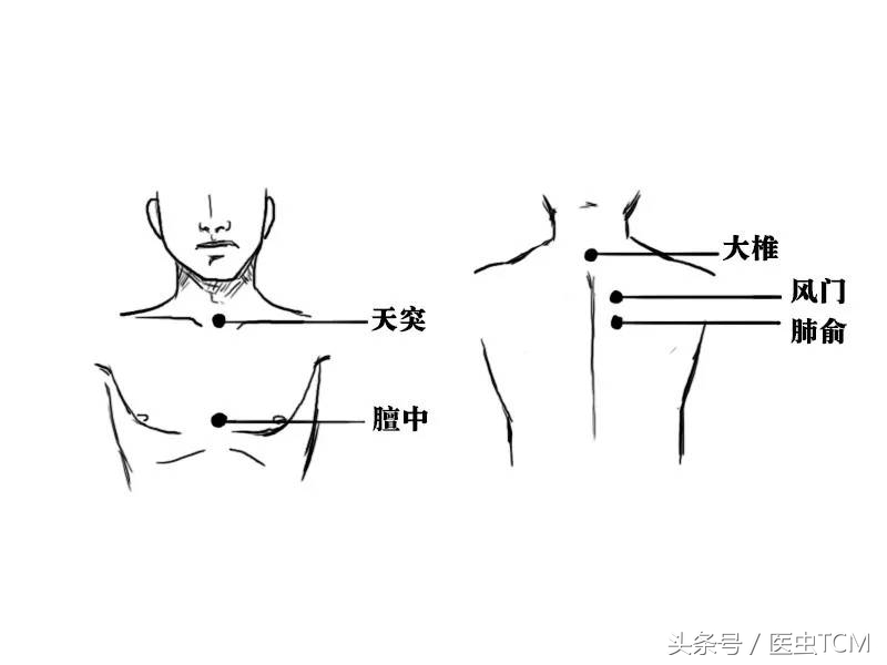 专家讲座治咳嗽的方法,专家治小儿咳嗽小妙招