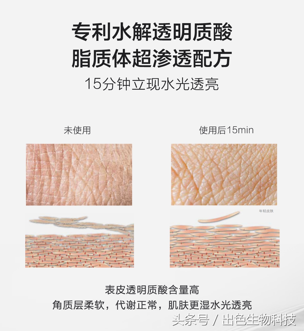 酵母活肤精华是什么牌子,活肤酵母精华