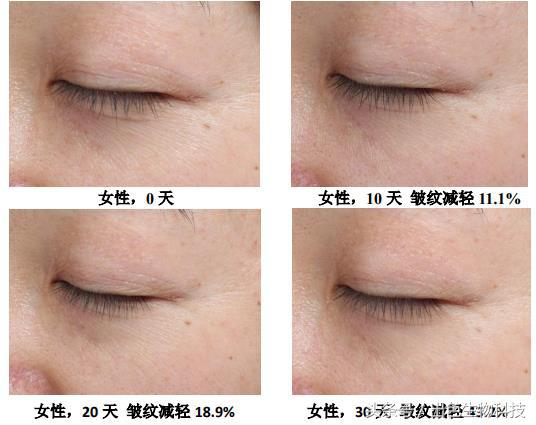 酵母活肤精华是什么牌子,活肤酵母精华