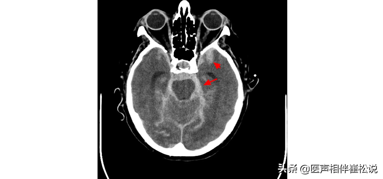 做好这几件事有助于康复,做好这四件事远离危险