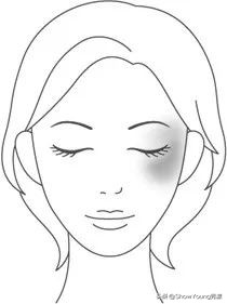 要肌肤像剥了壳的鸡蛋？你对斑了解多少？