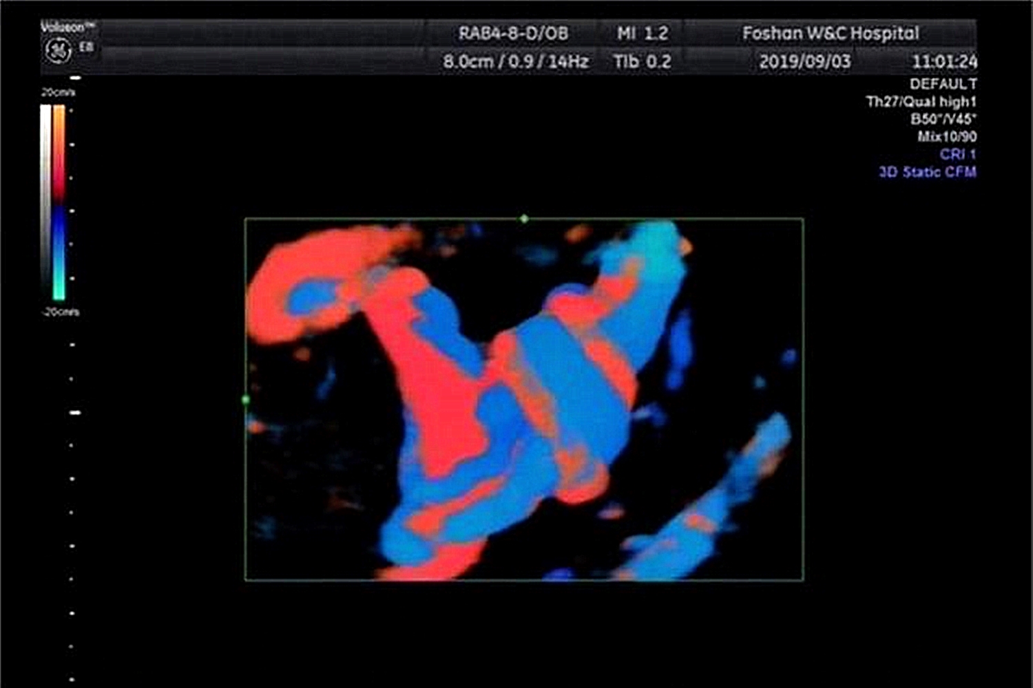 孕期第24周产检，发现胎儿脐带“打结”，孕妈起祈祷：愿宝宝平安