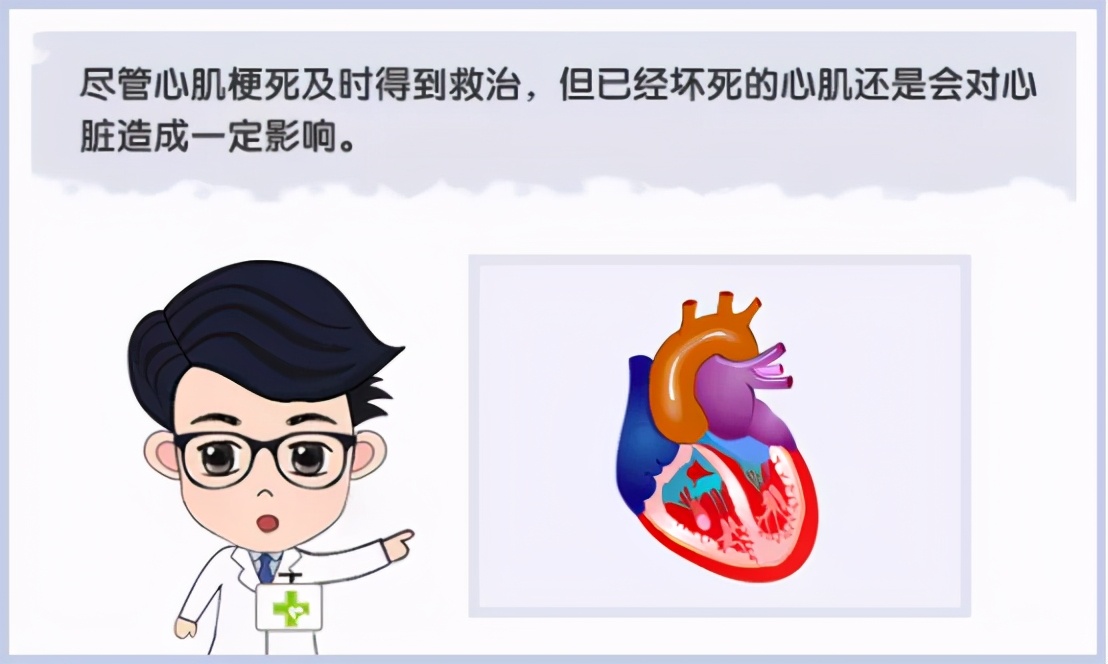 心肌梗塞多可怕,心肌梗死危险性