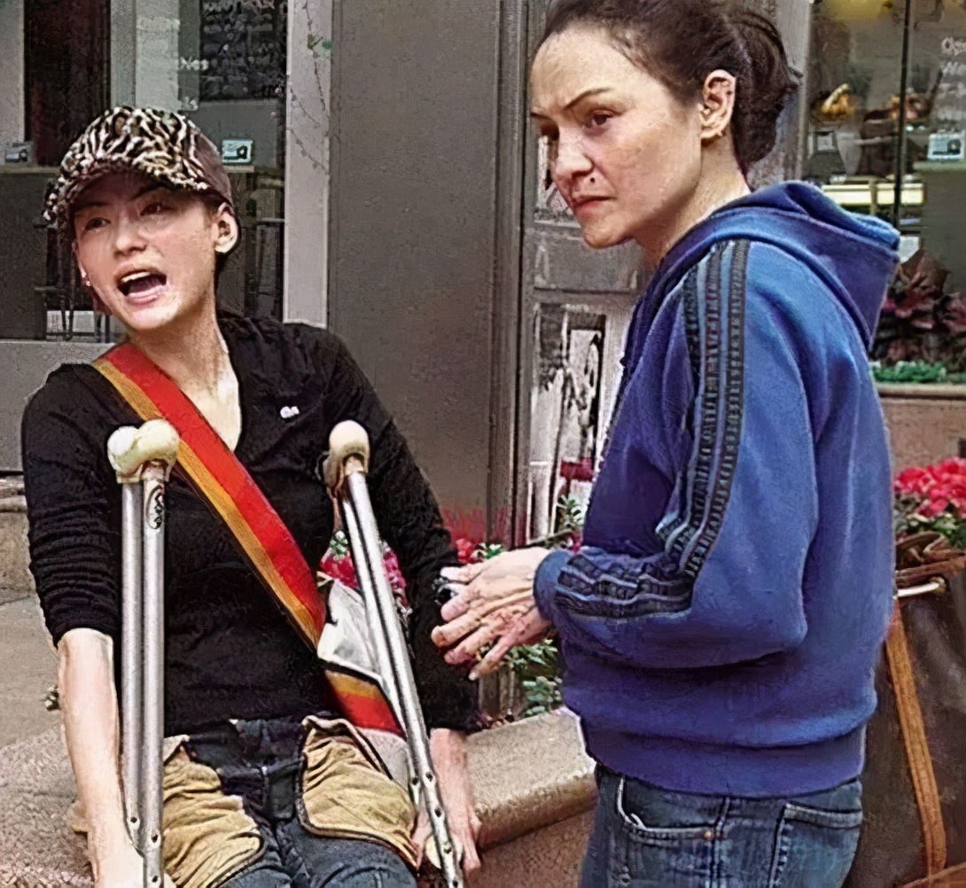 曝张柏芝受伤走路靠拐杖，脚腕缠纱布，谢霆锋忙晒美食太冷漠？