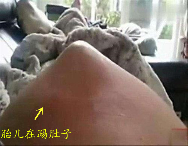 孕期肚子不同的4种“动静”，分别代表什么？准妈妈要仔细分清