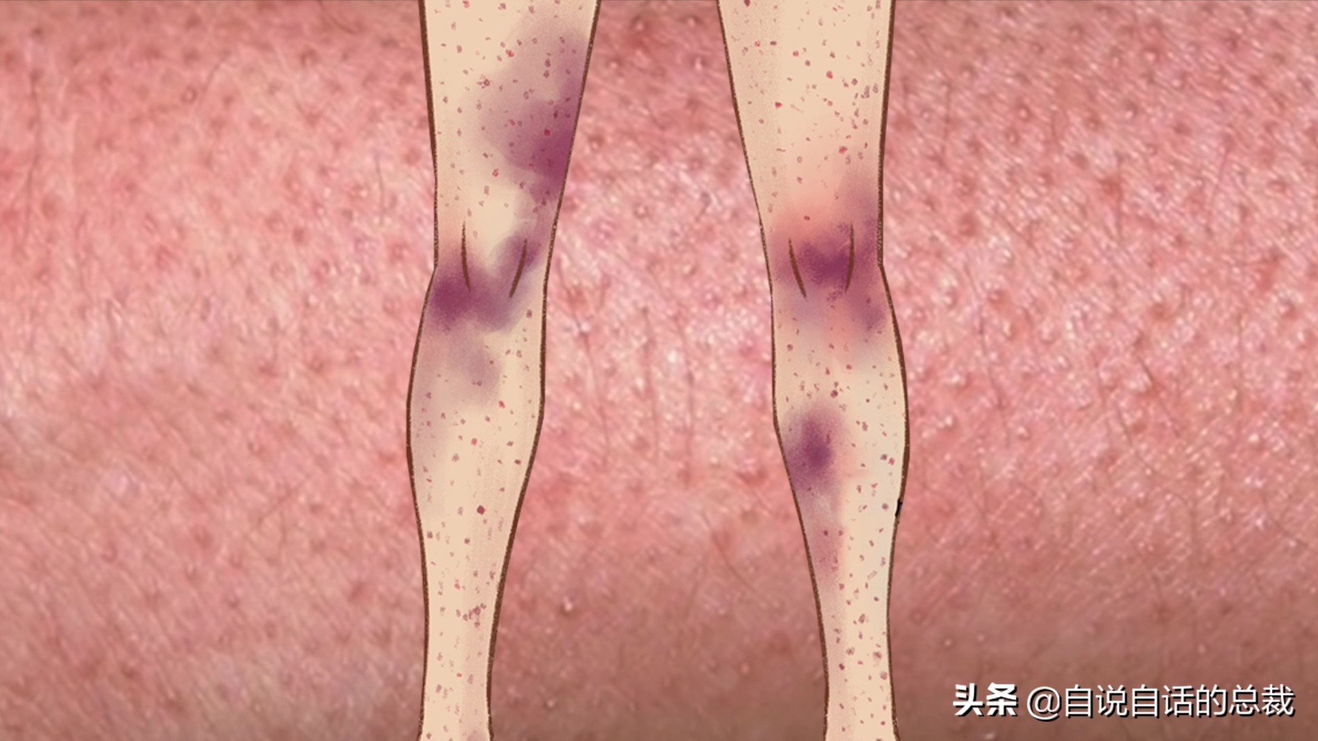 全世界的柠檬都读Lemon?这背后有一个刻在8号染色体上的上古故事