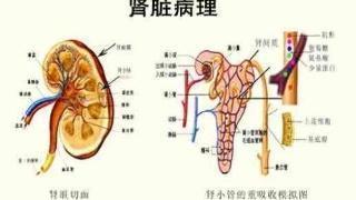 过敏性紫癜常见类型及鉴别,过敏性紫癜最常见的类型是什么