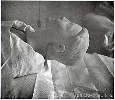 护理老人头发梳理与清洁,头部清理护理套餐