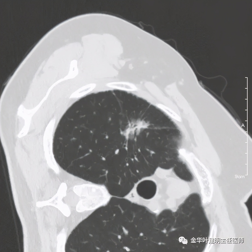 放个大招完整版教学,放个大招完整版前奏