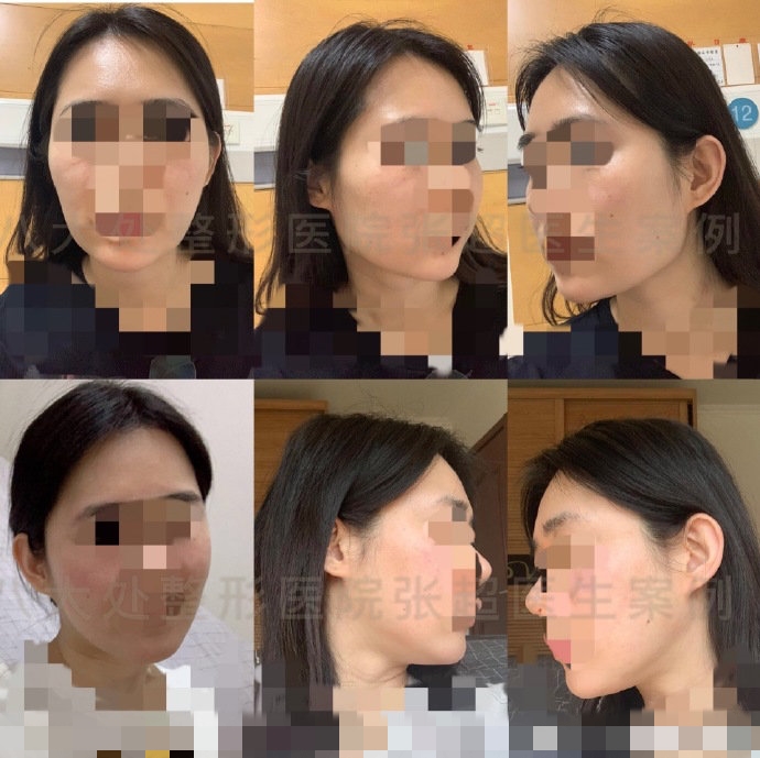 八大处张超抖音,八大处张超合集