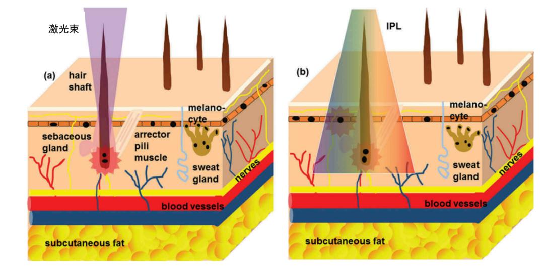 害怕脱毛怎么办,害怕腋下脱毛