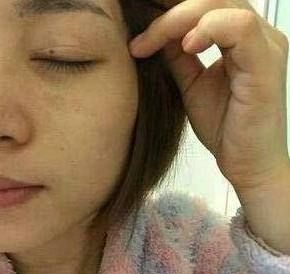 什么牌子老年斑的专用药膏见效快,老年斑的专用药膏