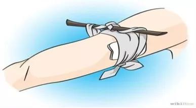 干货!国家体育总局运动医学博士的总结:运动损伤的急救和预防