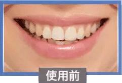 哪种牙膏去黄牙美白效果最好,用什么牙膏去黄美白效果最好