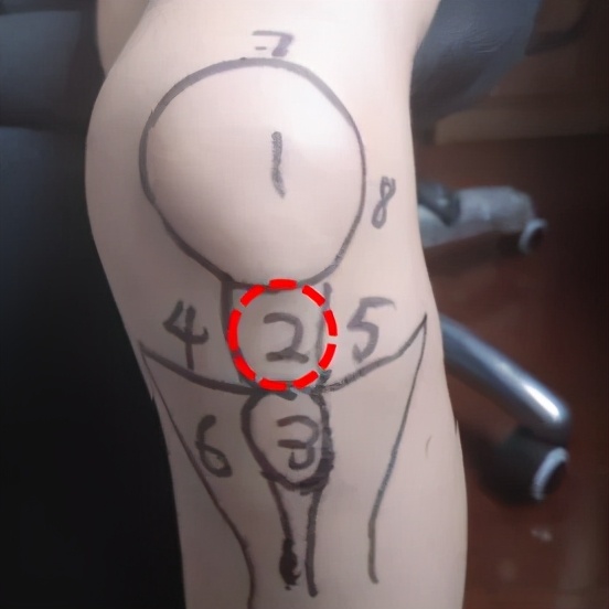 不同膝盖疼痛是暗示什么,不同位置的膝盖疼