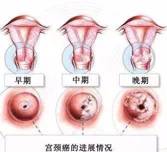 绝经了还需要检查性激素吗,绝经了还需要妇科检查吗